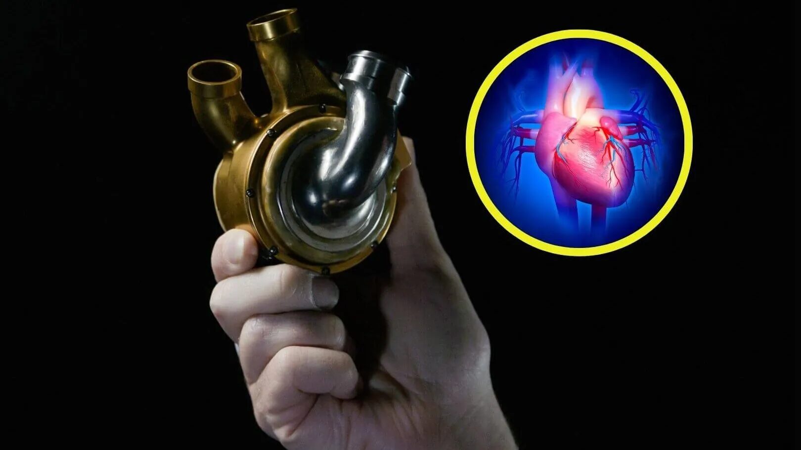HOMBRE SOBREVIVE 100 DÍAS CON CORAZÓN DE TITANIO
